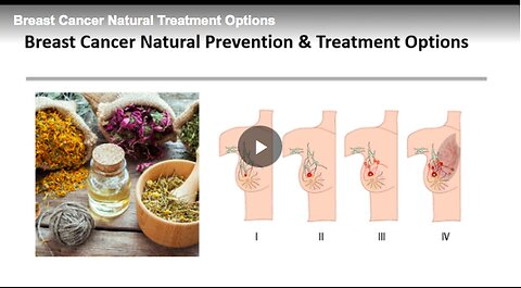 "Exploring Natural Treatment Options for Breast Cancer"