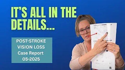 Detailed Breakdown of Vision Recovery After a Stroke