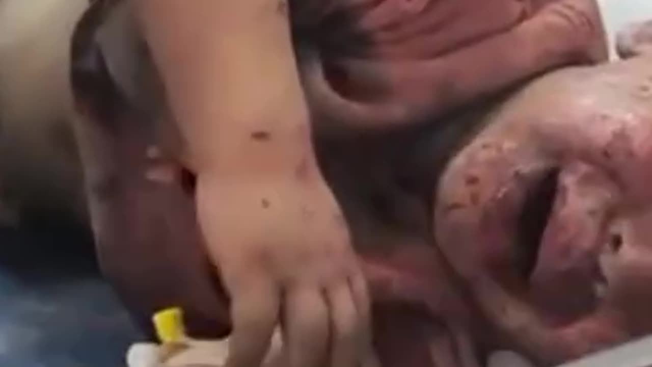 170 children martyred in just two days
