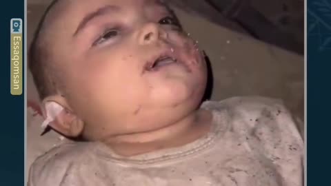 A number of martyrs and wounded, most of them children