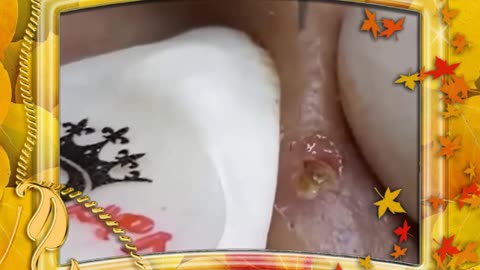 Skin with small black eyes.