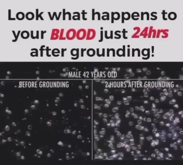 Look What Happens to Your Blood in just 24 hours after Grounding ~ Live longer & be healthier