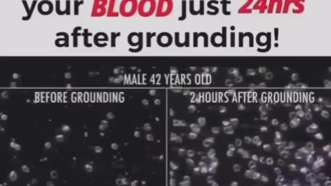 Look What Happens to Your Blood kust 24 hours after Grounding ~ Live longer & be healthier