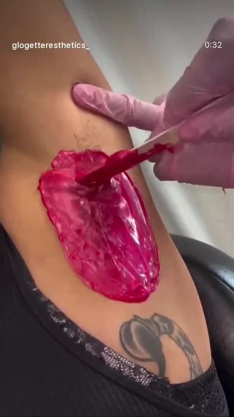 Underarm Waxing in Rhode Island Using Cherry Desire Scented Hard Wax by @glogetteresthetics_