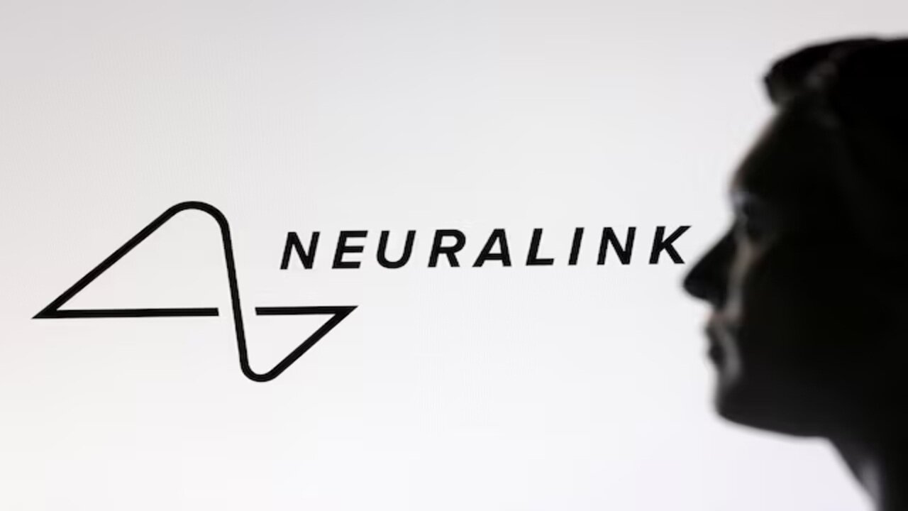 Neuralink implants 12 patients worldwide: MOTB Progress