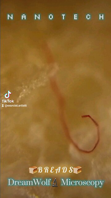 Finding in many breads. MorgellonRibbon biowiringBODY