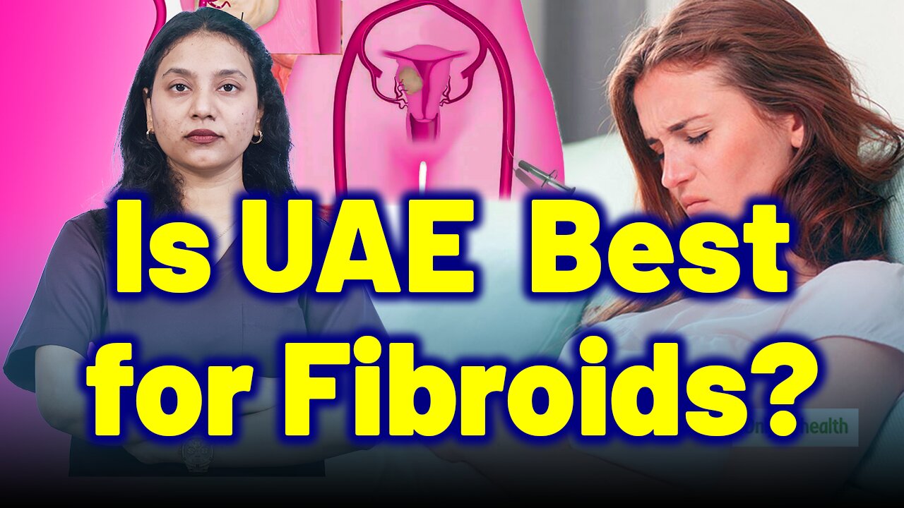 What is UAE, Uterine Fibroid Embolization for Fibroids? | Treatment & Cure | Homeopathy, Medicine