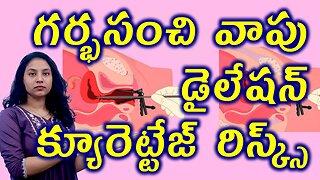 గర్భసంచి వాపు డైలేషన్, క్యూరెట్టేజ్ Bulky Uterus Dilation curettage (D&C) Treatment Risks Homeopathy