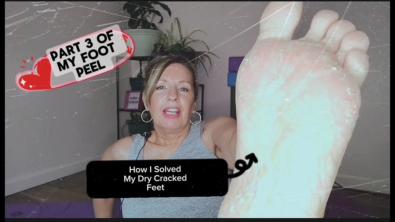 Part 3 of How I Solved my Dry Cracked Feet