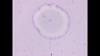 AntiNano Triangle Results (June 16, 2025)