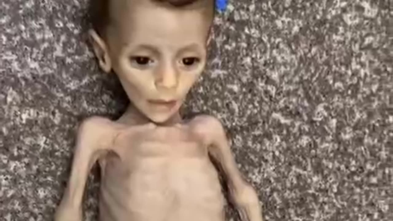 Gaza starvation