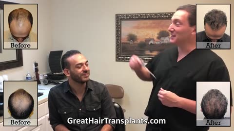 Dr. Brett Bolton – International Patient Karim Chooses MaxHarvest™ Hair Restoration