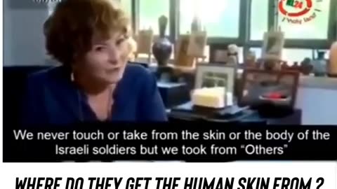 Skinned alive