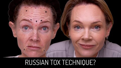 Testing Russian Toxin Techniques for a Lifted & Youthful Look!