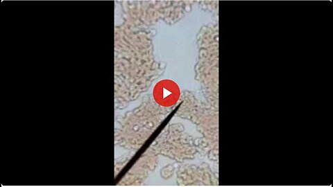 "Unveiling Chlorine Dioxide Solution's Remarkable Effects on Vaxxed, Graphenated Blood"