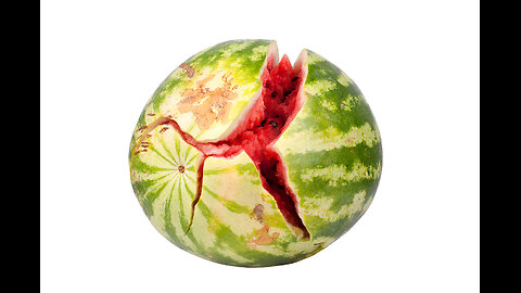 Concussions - Part 2