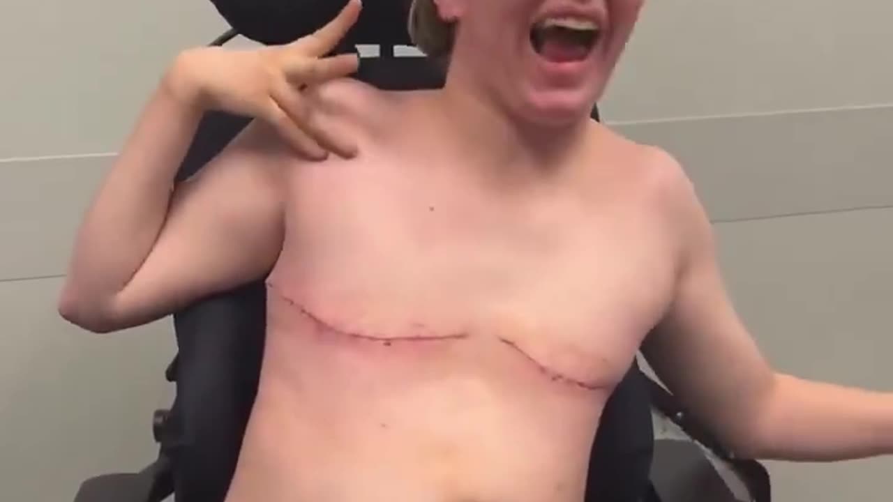 Before she turned 25, doctors amputated her breasts…