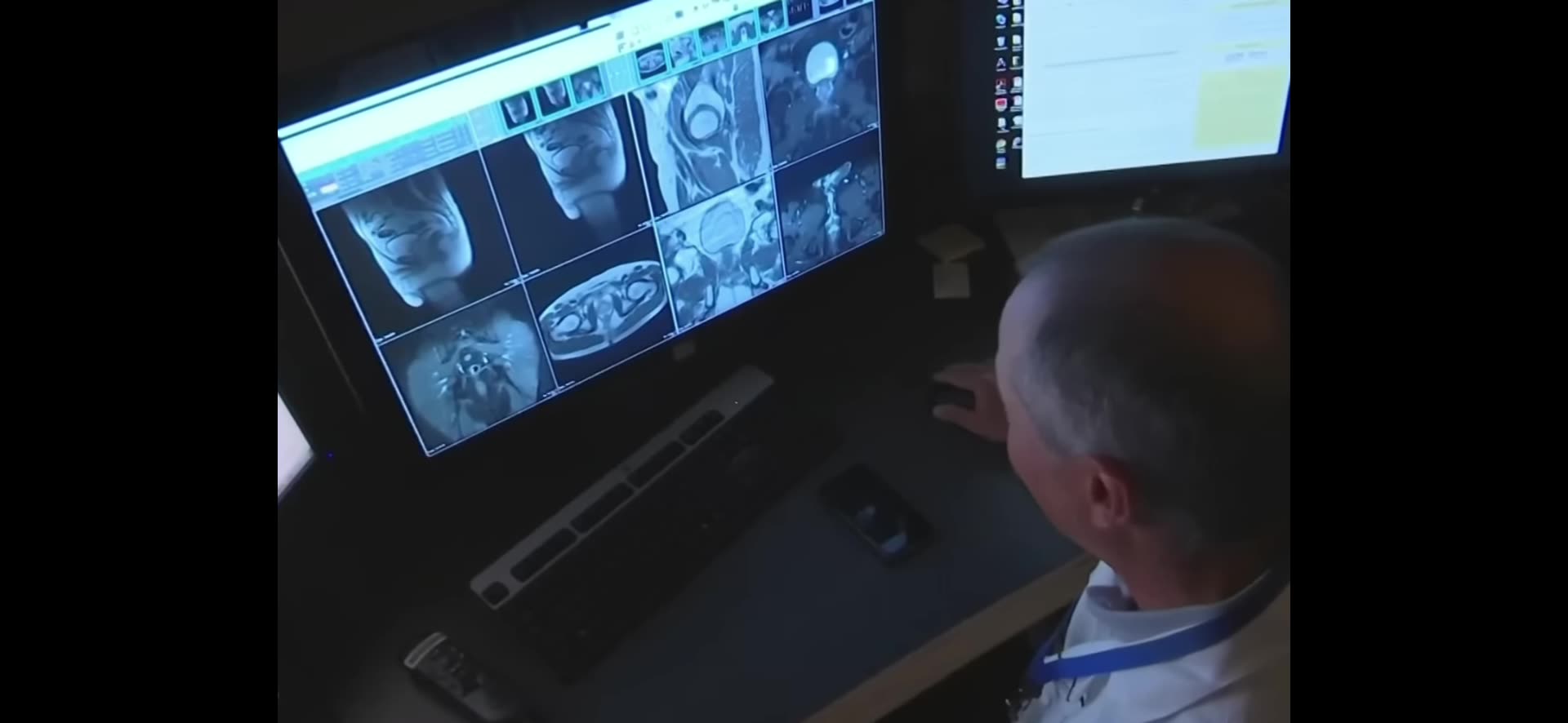 MRI Machines are Deadly