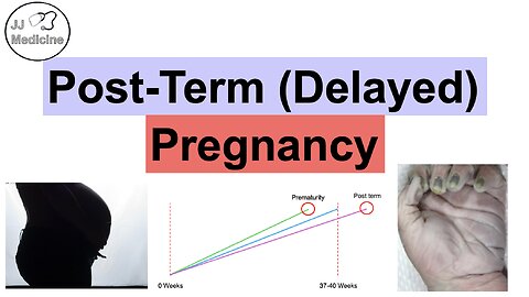 Post-Term Pregnancy & Post-Maturity Syndrome | Overview, Complications, Symptoms, Treatment