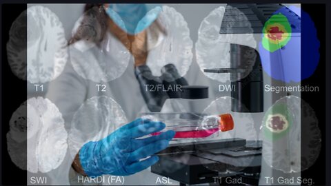 Big C and Little Orange Peel: What the Research Says