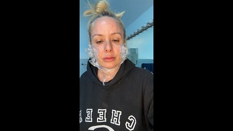 Neogenesis PDO mono and screw threads