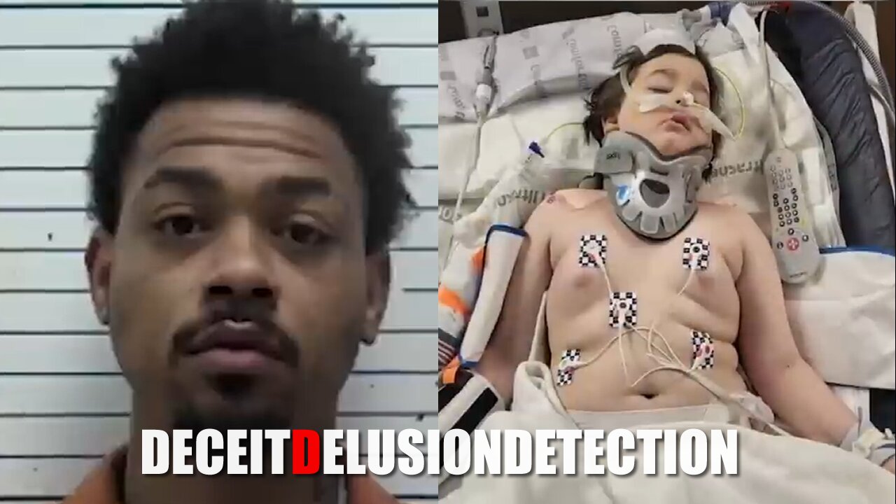 An 8-year-old white child was shot in the head by a black suspect while looking at Christmas lights with family