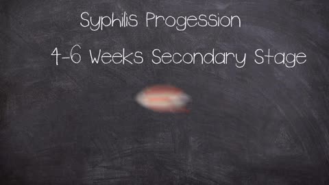 The Dark side of Science: The horror of the Tuskegee Syphilis Experiment (Short Documentary)