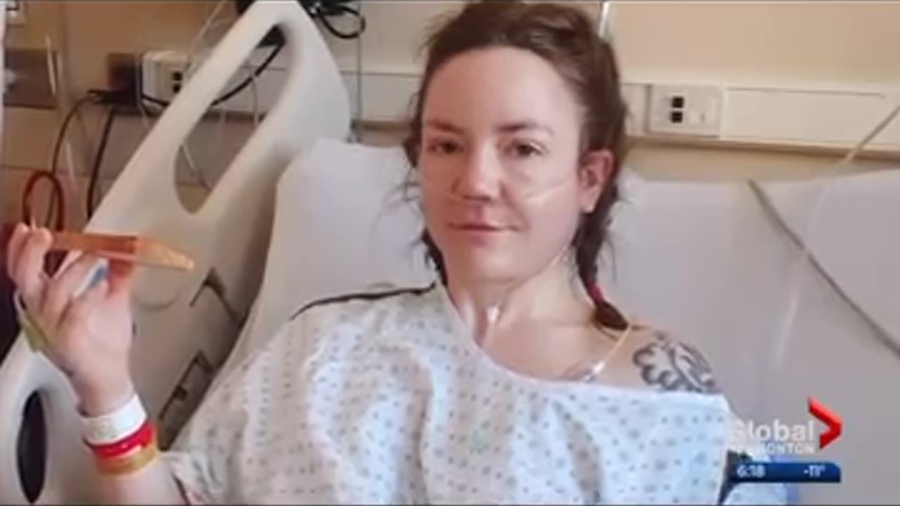 Parasite attacks Mimic Cancer A WOMAN'S CONCER IS ACTUALLY A PARASITE