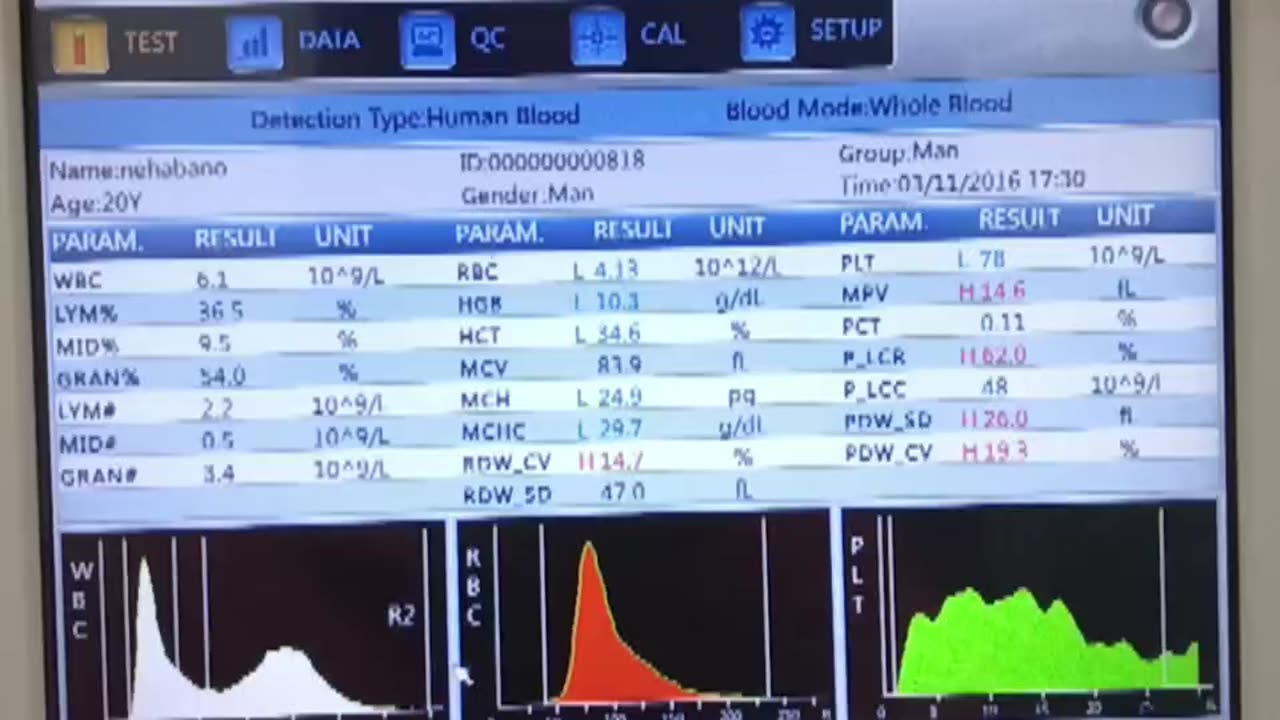 CBC ka sample lagane ka Sahi tarika||CBC widal||khoon jaanch||blood jaanch|typhoid jaanch#pathology