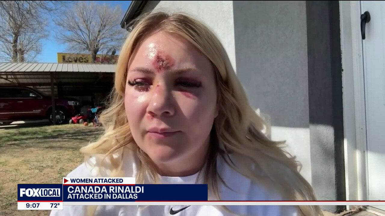 Oklahoma Bride-To-Be Attacked During Dallas Bachelorette Weekend: 'My Sister, My Sister'