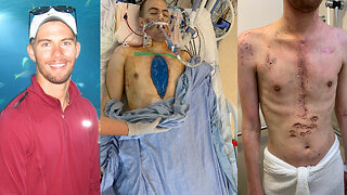 After being Vaccinated, my Son required at Heart Transplant.