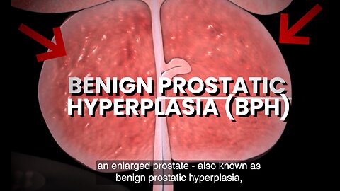 Discover this Brazilian prostate healing secret and use it tonight