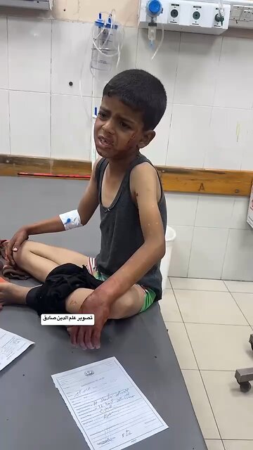 Child Injured in Bombing of Displaced Persons’ Tent in Khan Yunis