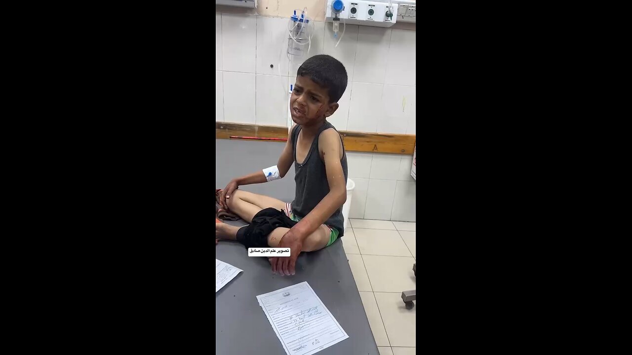 Child Injured in Bombing of Displaced Persons’ Tent in Khan Yunis