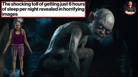 What You Will Look Like If You Chronically Run a Massive Sleep Deficit! It's NOT Precious!