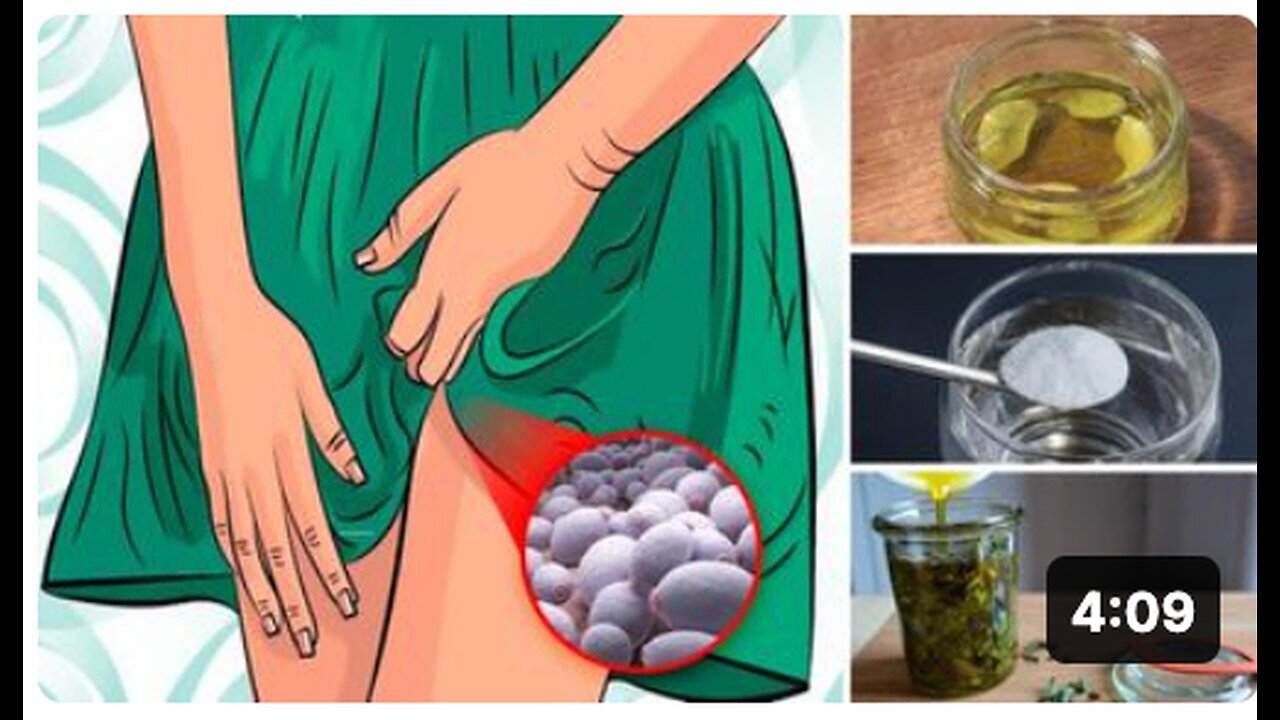 "8 Best Home Remedies for Treating Yeast Infection (Candidiasis)"