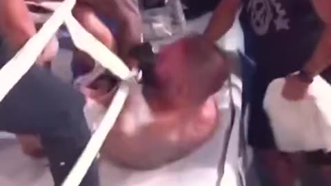 Georgi Valentinov, shocked fans last night after biting off a piece of his opponent’s ear