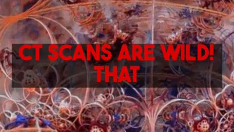 CT Scan Technology Revealed Equipment Behind The Images