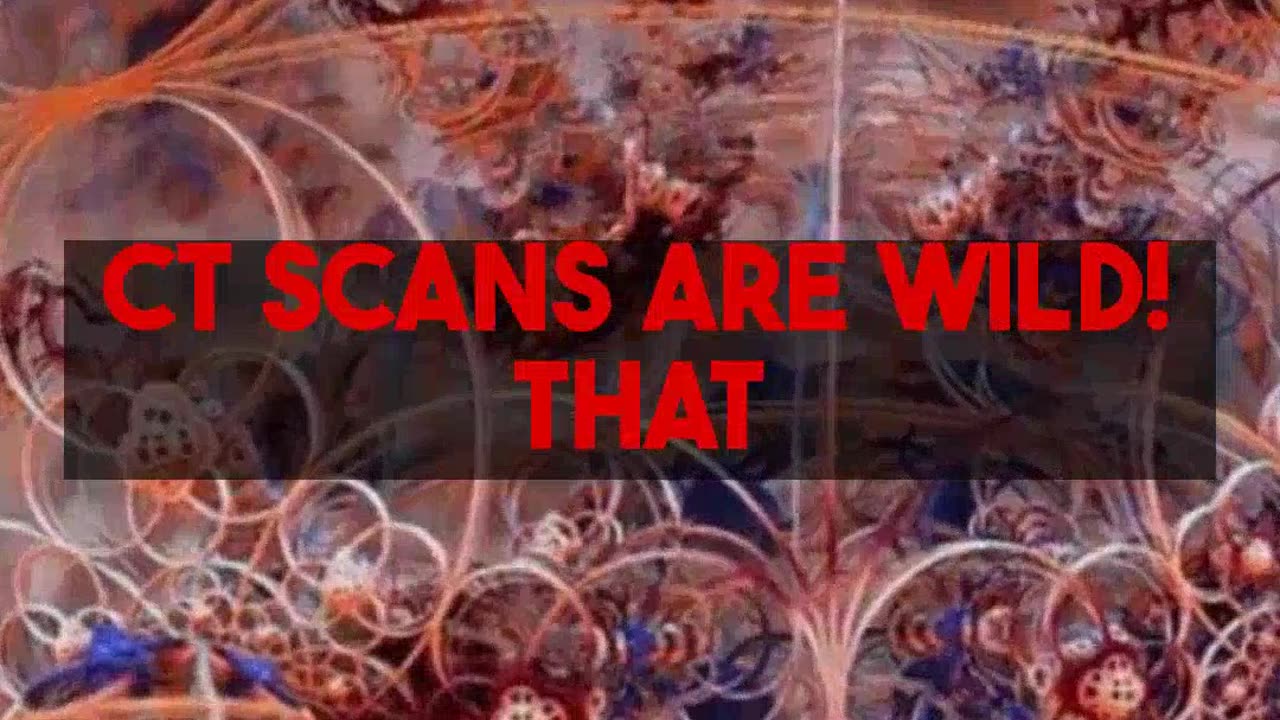 CT Scan Technology Revealed Equipment Behind The Images