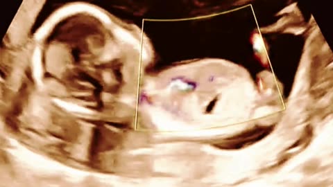 Sumathi Hospital: Advanced IVF, ICSI & IUI Fertility Treatments in Madurai