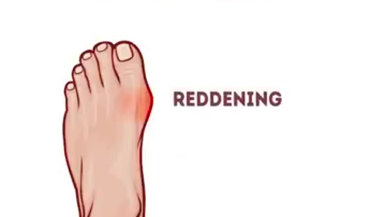 24 AWESOME TIPS TO MAKE YOUR FEET LOOK FABULOUS