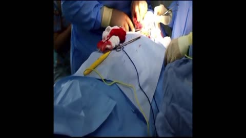 Episode 1 - Nelo the Surgeon, Medical Drama & Thriller! Surgery! Hypnosis! Romance!
