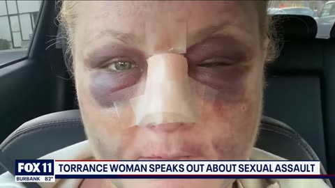 White woman sexually assaulted while walking her dogs by black sexual predator
