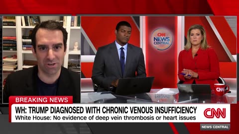 TRUMP diagnosed with chronic venous insufficiency following leg swelling