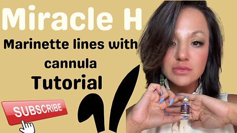 ✨Miracle H Cannula Treatment – Marionette Lines Glow-Up!