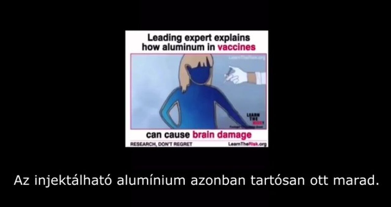 Az oltásokban lévő alumínium agykárosító hatása