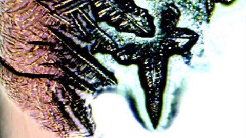 Microscopic analysis mixing blood with saline creates crystals explosion under microscope pt1