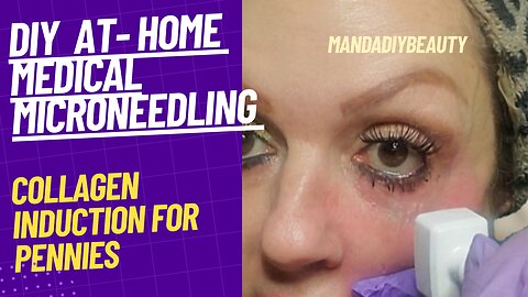 DIY AT- Home Medical Microneedling with Dermastamp