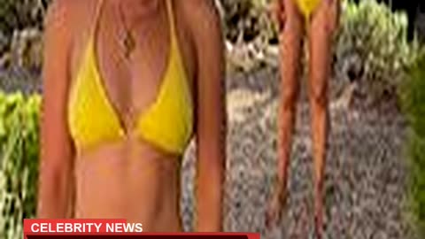 Louise Thompson Proudly Displays Her Stoma Bag in