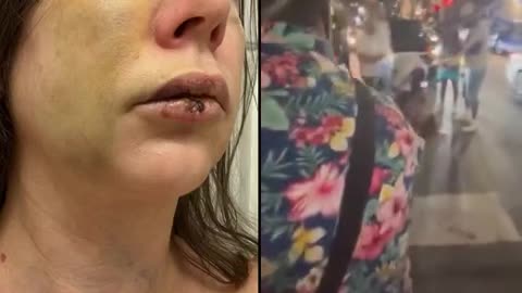 Senator Bernie Moreno released video of woman racial attack victim